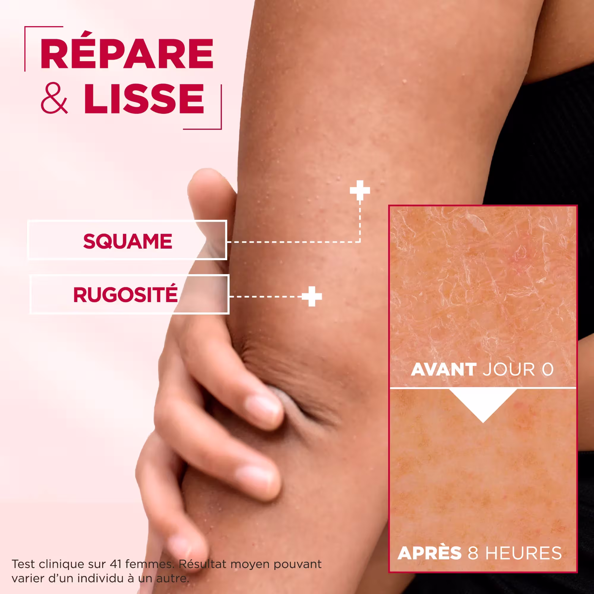 Mixa-Creme-Cica-Reparation-Peaux-Tres-Seches-et-Rugueuses-Visage-Corps-Mains-400ml